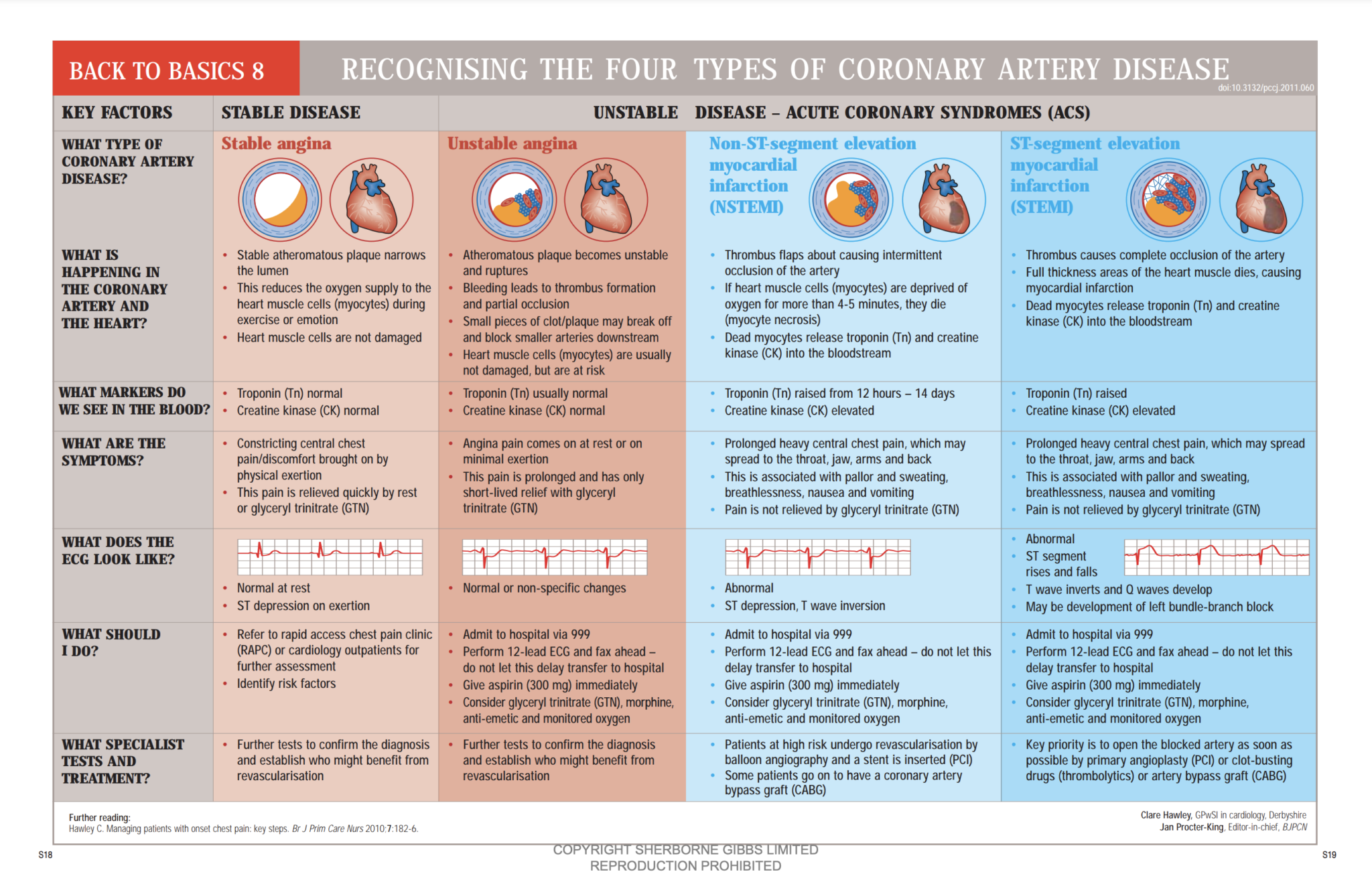 Back to Basics: Recognising the four types of coronary artery disease
