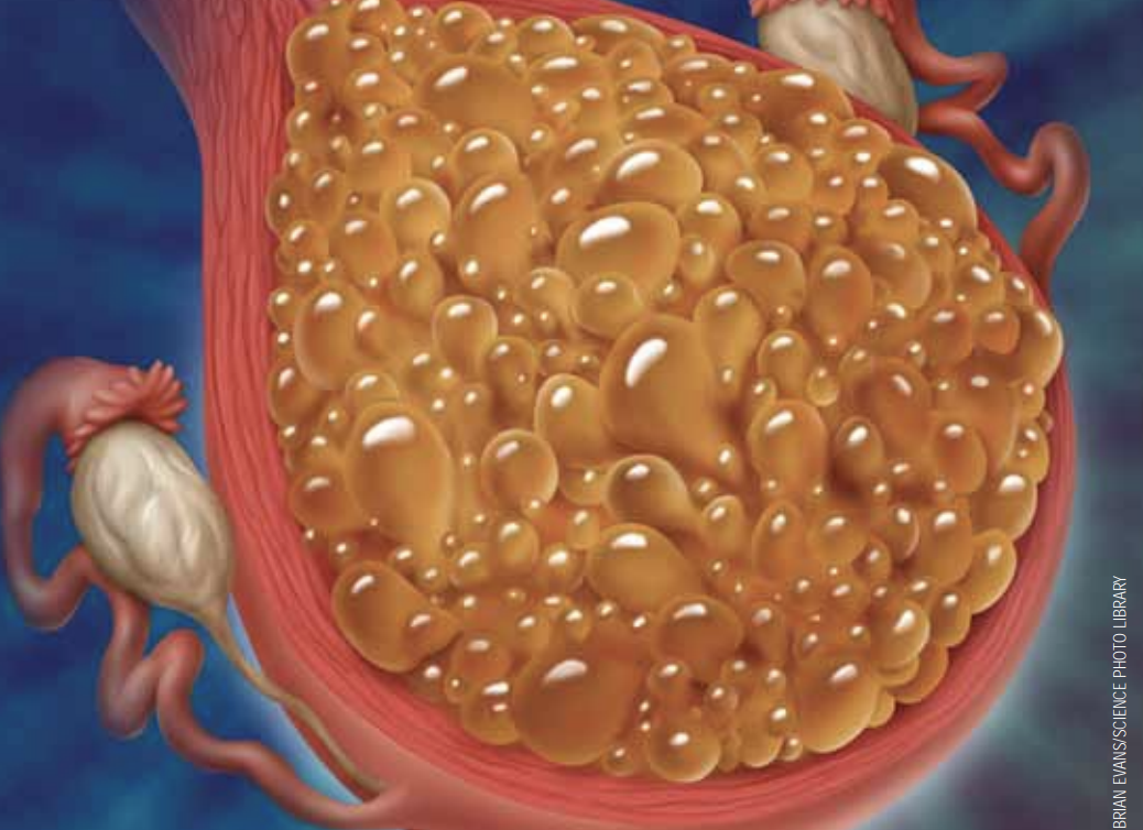 Molar pregnancy: An essential diagnosis - Issues and Answers