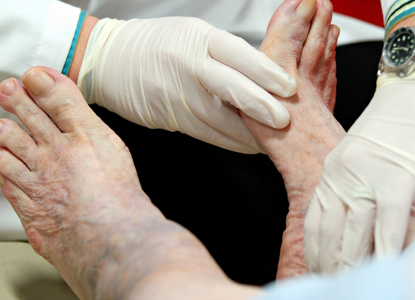 A guide to the diabetic foot check Issues and Answers